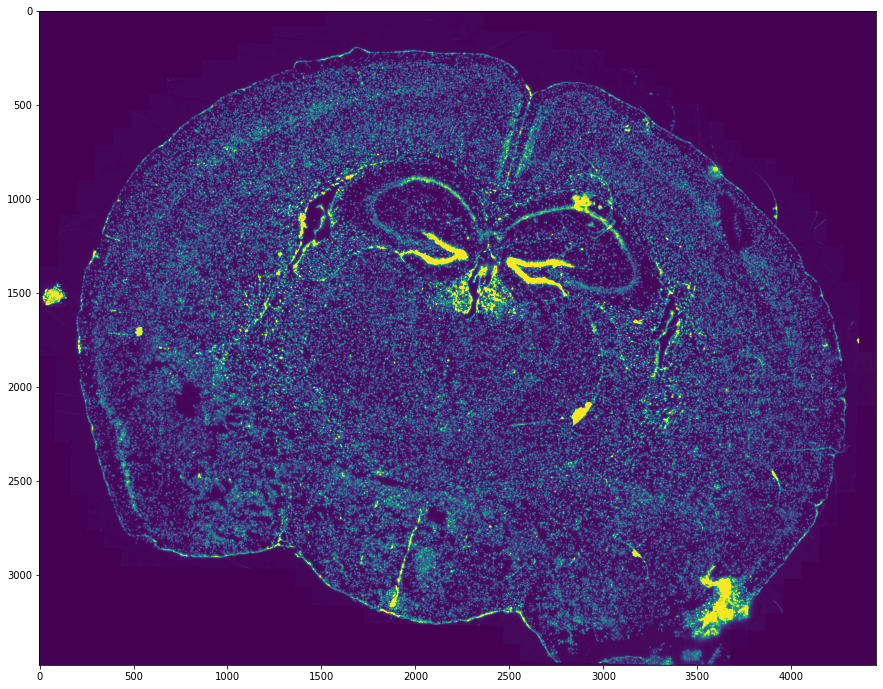 MERFISH coronal mouse-brain section reconstructed from spatial transcript positions